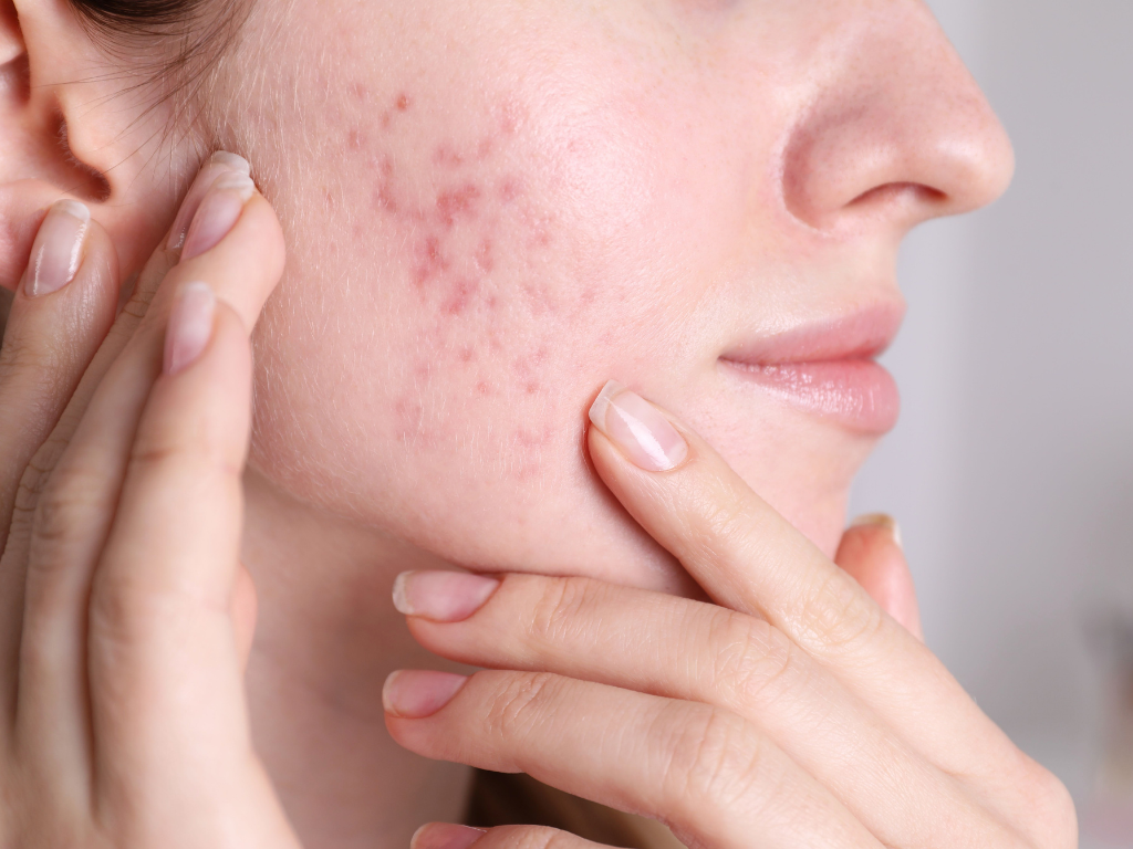 Why Scar Type Dictates the Entire Treatment Plan 