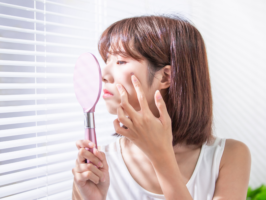 Acne Scars: What They Are and Why They Do Not Fade 