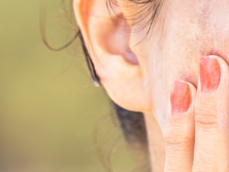 Pigmentation Treatment Singapore: The Dermatology Guide