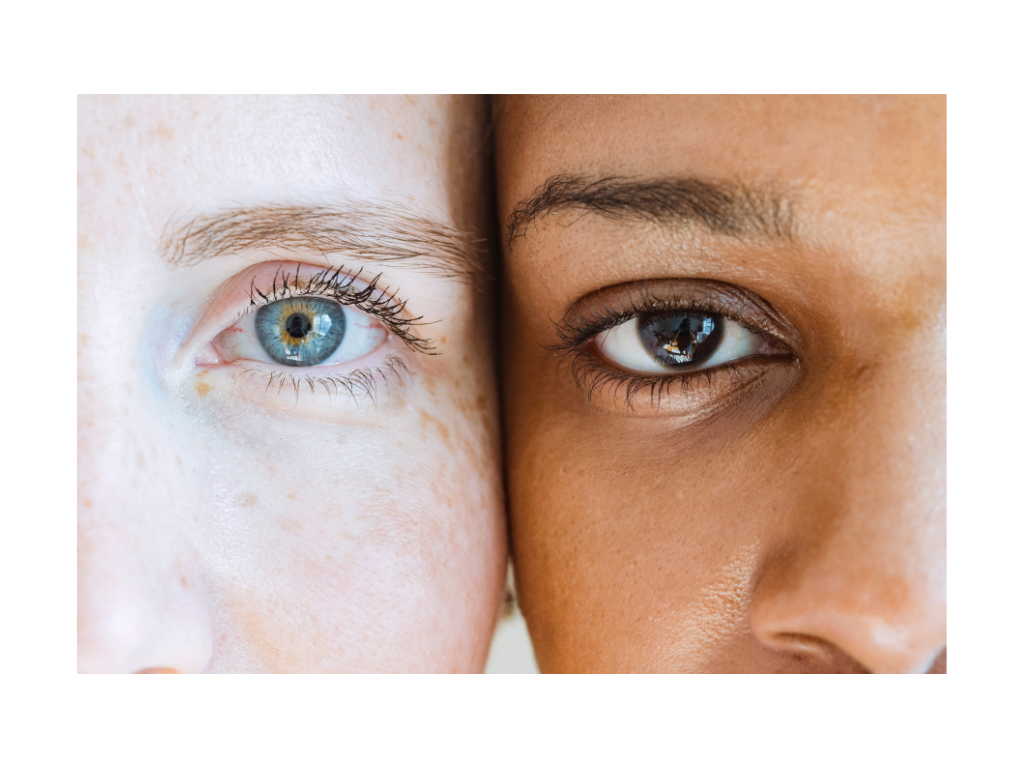 Is melasma a type of hyperpigmentation, or something different?
