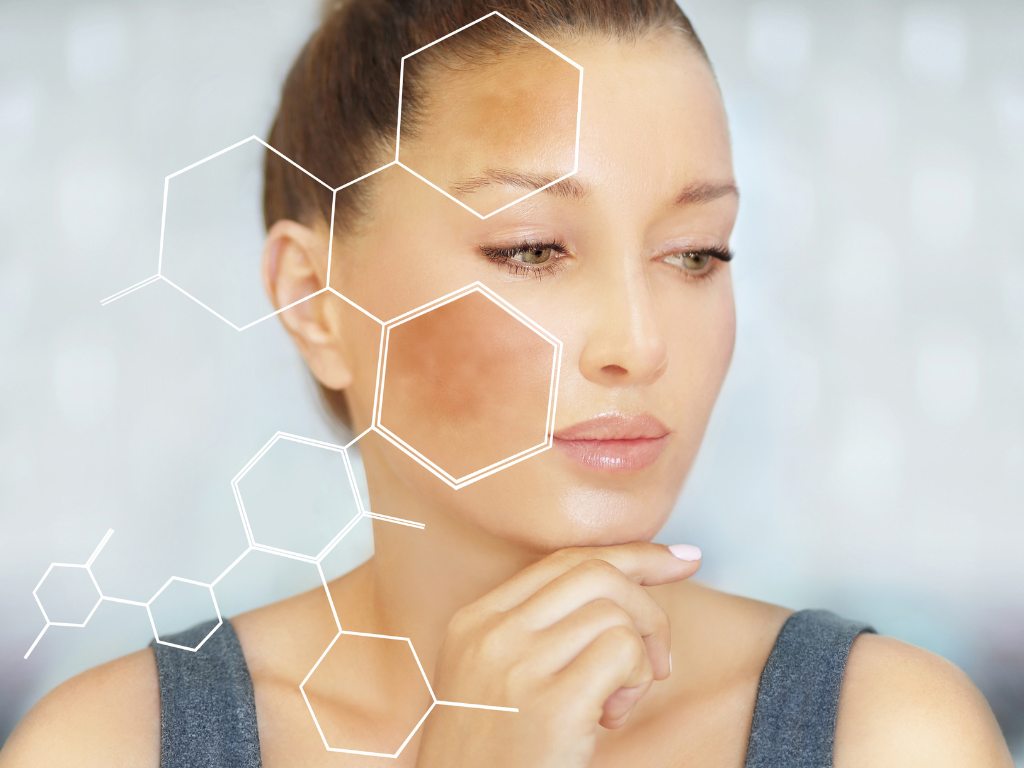How does sunlight actually make melasma worse?
