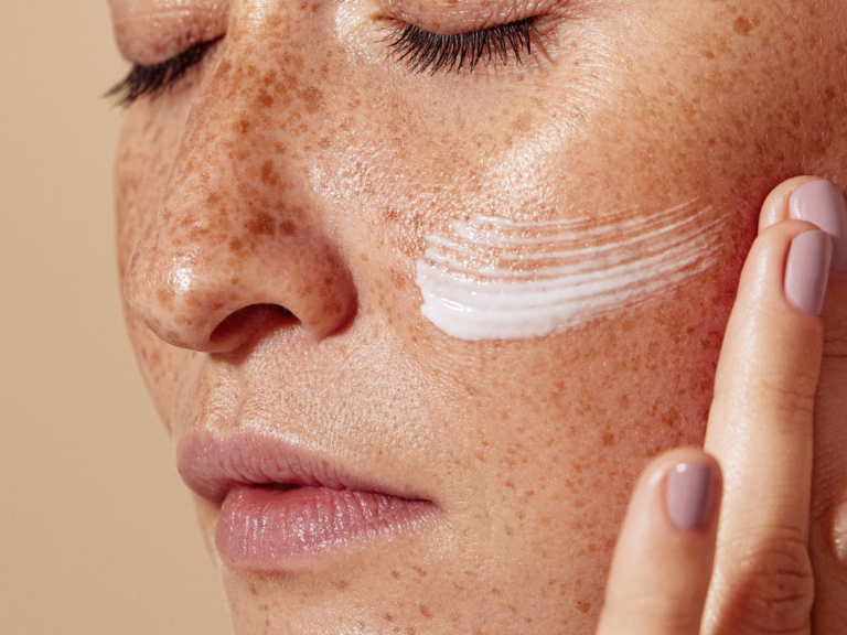 Types of Facial Pigmentation: How to Tell Them Apart
